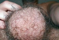 Hairy_balls_ 2.jpg